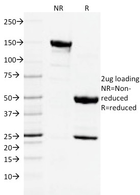 Data from SDS-PAGE analysis of Anti-CD3 antibody (Clone C3e/2478). Reducing lane (R) shows heavy and light chain fragments. NR lane shows intact antibody with expected MW of approximately 150 kDa. The data are consistent with a high purity, intact mAb.